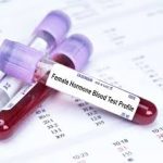 hormone test